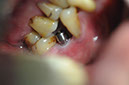 %_tempFileNameImplant%2068b4%