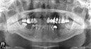 %_tempFileNameImplant%2068d1%