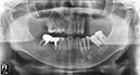 %_tempFileNameImplant%2069d1%