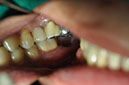 %_tempFileNameImplant%2072a1%