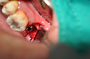 %_tempFileNameImplant%2072b1%