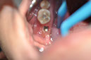 %_tempFileNameImplant%2072b2%