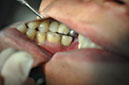 %_tempFileNameImplant%2072c2%