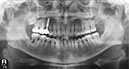 %_tempFileNameImplant%2072d1%