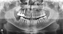 %_tempFileNameImplant%2072d2%