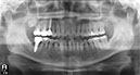 %_tempFileNameImplant%2072d3%