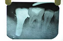%_tempFileNameImplant%2072d4%