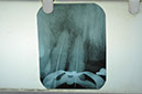 %_tempFileNameImplant%2074a2%