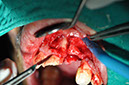 %_tempFileNameImplant%2074b1%