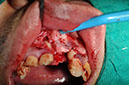 %_tempFileNameImplant%2074b2%