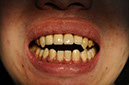 %_tempFileNameImplant%2074c3%