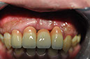 %_tempFileNameImplant%2074c4%