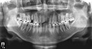 %_tempFileNameImplant%2074d1%