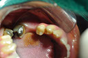 %_tempFileNameImplant%2075a1%
