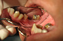 %_tempFileNameImplant%2075a2%
