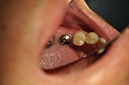 %_tempFileNameImplant%2075b1%