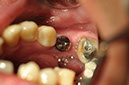 %_tempFileNameImplant%2075b2%