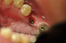 %_tempFileNameImplant%2075b3%