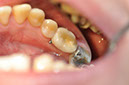 %_tempFileNameImplant%2075c1%