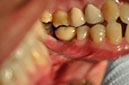 %_tempFileNameImplant%2075c2%