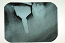 %_tempFileNameImplant%2075c3%