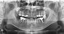%_tempFileNameImplant%2075d2%