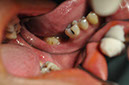%_tempFileNameImplant%2076a1%