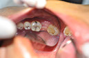 %_tempFileNameImplant%2076a2%