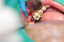 %_tempFileNameImplant%2076b1%