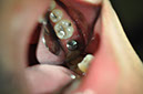 %_tempFileNameImplant%2076b3%