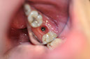 %_tempFileNameImplant%2076b4%