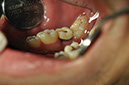 %_tempFileNameImplant%2076c2%