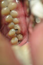 %_tempFileNameImplant%2076c3%