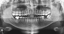 %_tempFileNameImplant%2076d1%