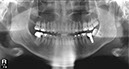 %_tempFileNameImplant%2076d2%