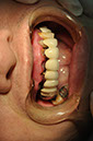 %_tempFileNameImplant%2077a1%