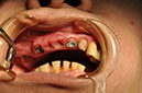 %_tempFileNameImplant%2077a3%