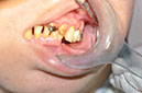 %_tempFileNameImplant%2077a4%