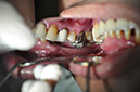 %_tempFileNameImplant%2077a5%