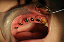 %_tempFileNameImplant%2077b1%