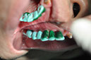 %_tempFileNameImplant%2077b2%