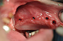 %_tempFileNameImplant%2077b3%