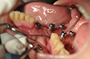 %_tempFileNameImplant%2077b4%