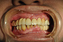 %_tempFileNameImplant%2077c1%