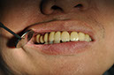 %_tempFileNameImplant%2077c3%