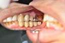%_tempFileNameImplant%2077c4%