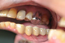 %_tempFileNameImplant%2077c5%