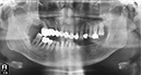 %_tempFileNameImplant%2077d1%