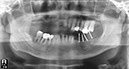 %_tempFileNameImplant%2077d2%