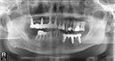 %_tempFileNameImplant%2077d3%